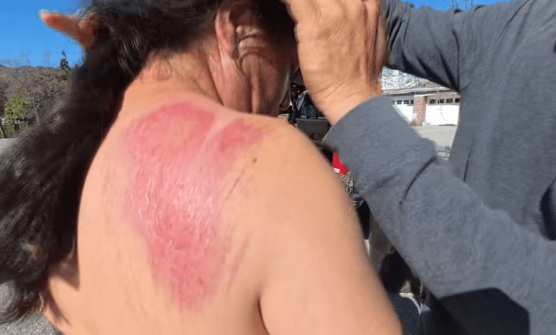 Landscapers brutally beaten, robbed of tools on Southern California job site Landscapers brutally beaten, robbed of tools on Southern California job site