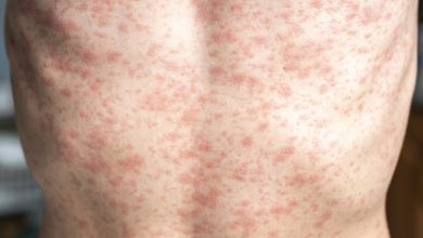 Portland shoppers avoid exposure sites amid measles outbreak Portland shoppers avoid exposure sites amid measles outbreak