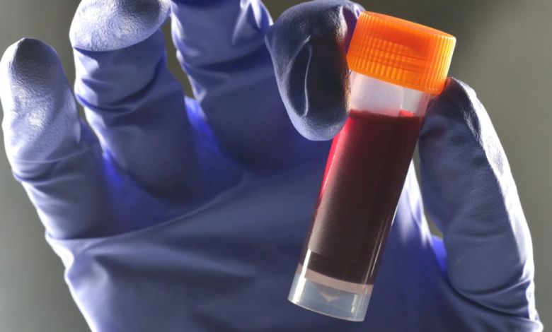 One Blood Type Appears to Carry a Higher Risk of Type 2 Diabetes One Blood Type Appears to Carry a Higher Risk of Type 2 Diabetes