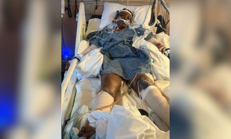 Woman hospitalized after dog mauling in Mississippi Woman hospitalized after dog mauling in Mississippi