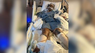 Woman hospitalized after dog mauling in Mississippi Woman hospitalized after dog mauling in Mississippi