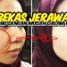 Cara Ampuh Menghilangkan Bekas Jerawat Dengan Cepat Cara Ampuh Menghilangkan Bekas Jerawat Dengan Cepat