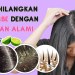 Cara Mengatasi Ketombe Dengan Bahan Alami Cara Mengatasi Ketombe Dengan Bahan Alami