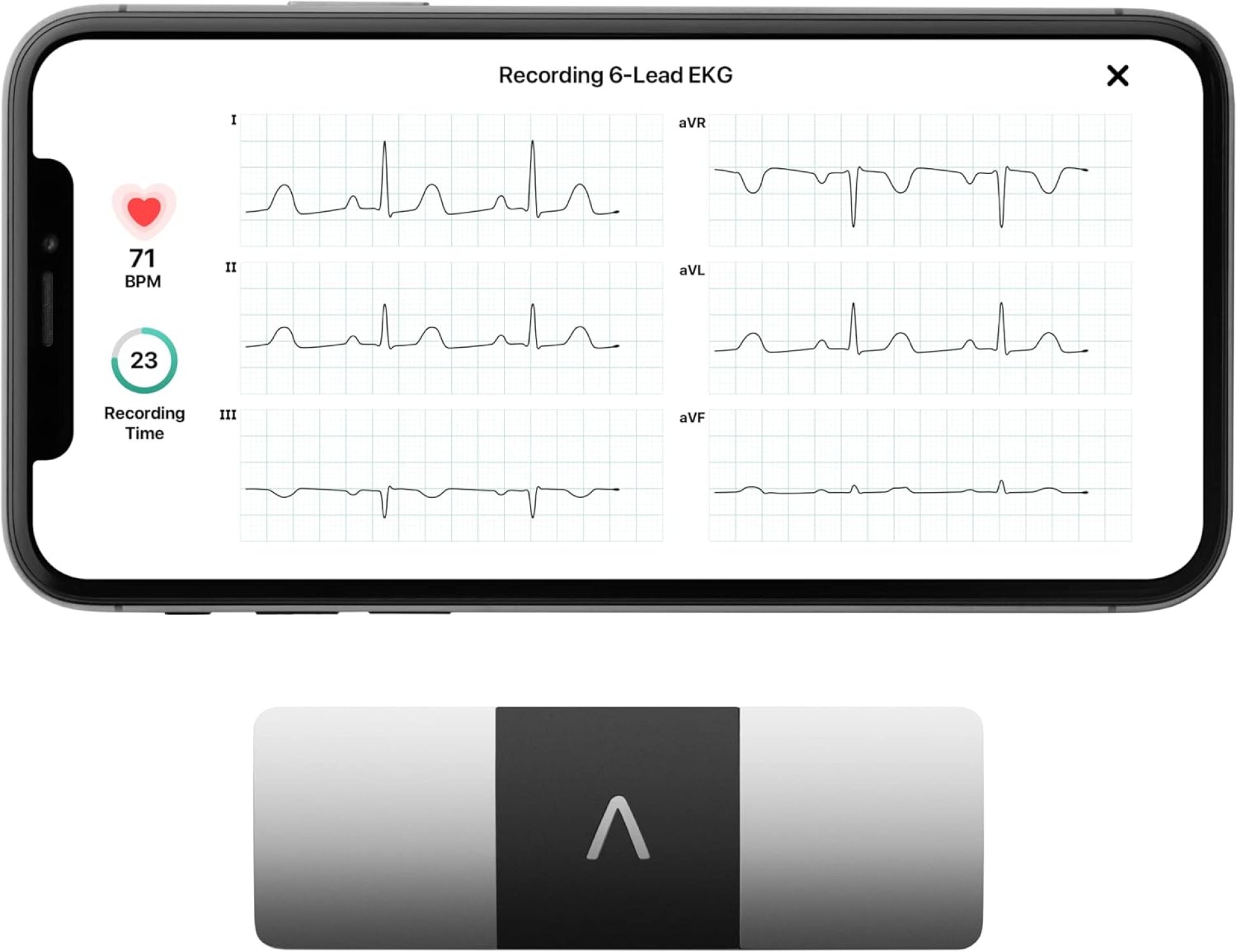 KardiaMobile 6-Lead Personal EKG Monitor – Six Views of The Heart – Detects AFib and Irregular Arrhythmias – Instant Results in 30 Seconds – Works with Most Smartphones – FSA/HSA Eligible KardiaMobile 6-Lead Personal EKG Monitor – Six Views of The Heart – Detects AFib and Irregular Arrhythmias – Instant Results in 30 Seconds – Works with Most Smartphones – FSA/HSA Eligible
