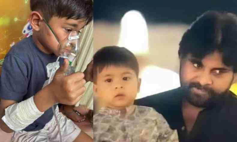 Pawan Kalyan’s son in hospital after fire accident Pawan Kalyan’s son in hospital after fire accident