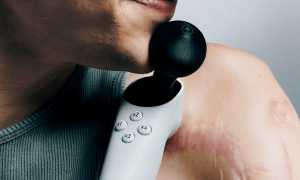 Microsoft’s Xbox Adaptive Joystick is now available Microsoft’s Xbox Adaptive Joystick is now available