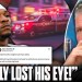 Anthony Richardson’s Freak Accident With Resistance Band Nearly Cost Him His Eye?! | Pat McAfee Show Anthony Richardson’s Freak Accident With Resistance Band Nearly Cost Him His Eye?! | Pat McAfee Show