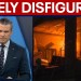 Iran war: Supreme Leader ‘wounded & likely disfigured,’ Hegseth says Iran war: Supreme Leader ‘wounded & likely disfigured,’ Hegseth says