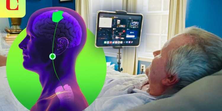 Synchron vs. Neuralink: BCI Brain Implants for Thought-Control Synchron vs. Neuralink: BCI Brain Implants for Thought-Control