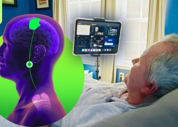 Synchron vs. Neuralink: BCI Brain Implants for Thought-Control Synchron vs. Neuralink: BCI Brain Implants for Thought-Control