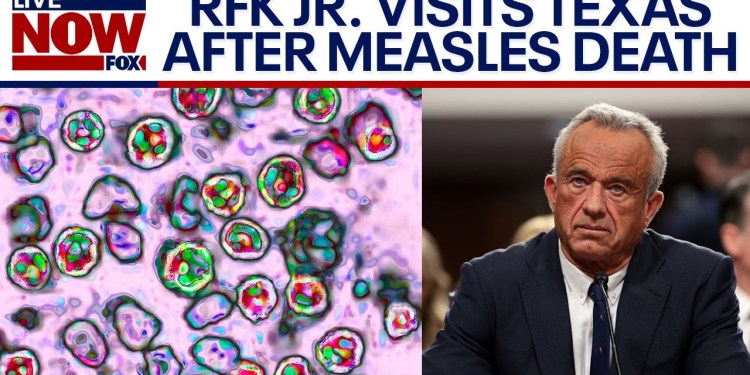 Second child dies of measles in Texas, RFK Jr. attends funeral | LiveNOW from FOX Second child dies of measles in Texas, RFK Jr. attends funeral | LiveNOW from FOX