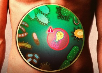 Hacking the Microbiome to Fight Cancer Hacking the Microbiome to Fight Cancer