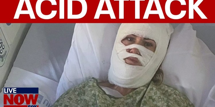 Savannah acid attack: Woman severely burned in “unprovoked attack” Savannah acid attack: Woman severely burned in “unprovoked attack”