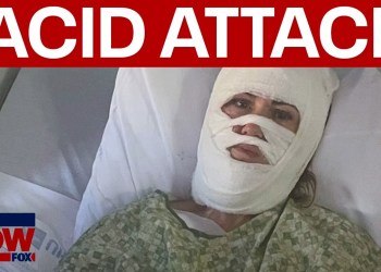 Savannah acid attack: Woman severely burned in “unprovoked attack” Savannah acid attack: Woman severely burned in “unprovoked attack”