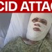 Savannah acid attack: Woman severely burned in “unprovoked attack” Savannah acid attack: Woman severely burned in “unprovoked attack”