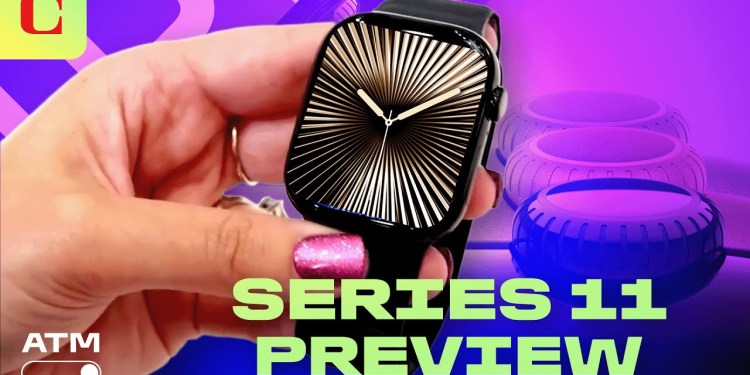 Apple Watch Series 11: What to Expect Apple Watch Series 11: What to Expect