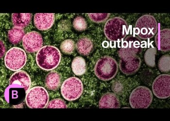 Mpox Outbreak: Here’s What You Need to Know About Potentially Deadly Virus Mpox Outbreak: Here’s What You Need to Know About Potentially Deadly Virus