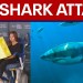 9-year-old bit by shark off Florida beach, has emergency surgery 9-year-old bit by shark off Florida beach, has emergency surgery