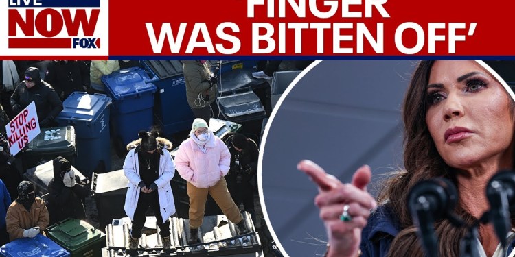 WATCH: Noem says ‘agent’s finger was bitten off’ following unrest in Minneapolis WATCH: Noem says ‘agent’s finger was bitten off’ following unrest in Minneapolis