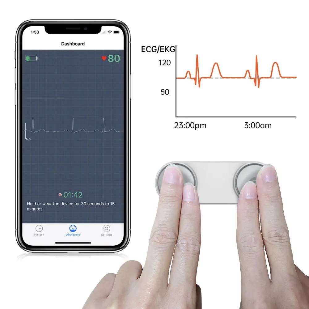 Kardena MED: DuoEK S – Mobiles EKG-Gerät mit App & Analyse – Bild 5