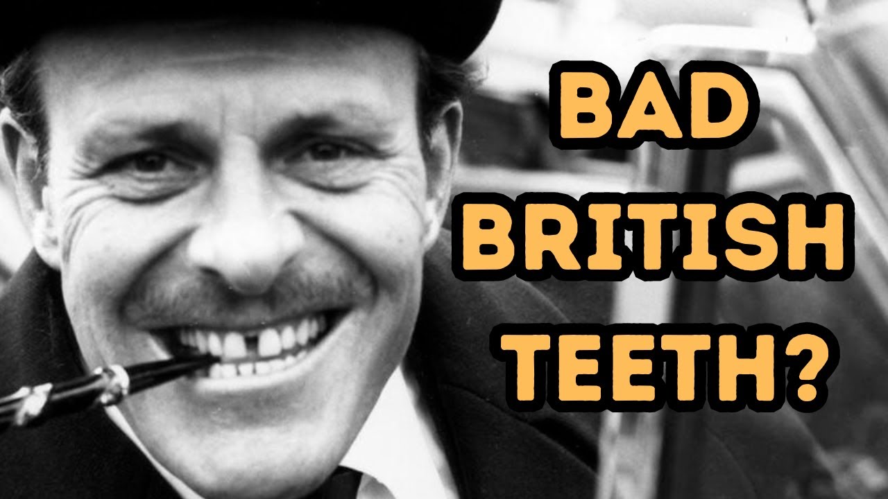 Why Are British Teeth So Yellow? Why Are British Teeth So Yellow?