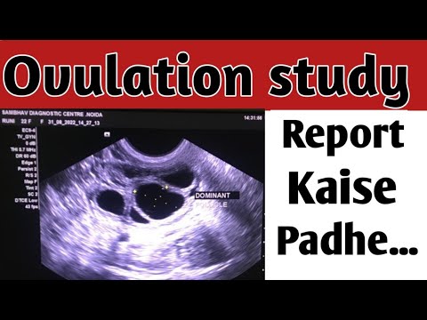 How to read follicular monitoring/egg report? How to read follicular monitoring/egg report?