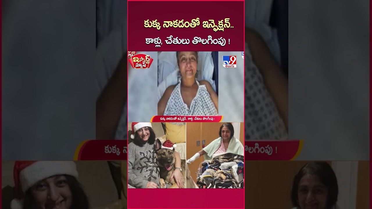 iSmart News : కుక్క నాకడంతో ఇన్ఫెక్షన్.. కాళ్లు, చేతులు తొలగింపు! – TV9 iSmart News : కుక్క నాకడంతో ఇన్ఫెక్షన్.. కాళ్లు, చేతులు తొలగింపు! – TV9