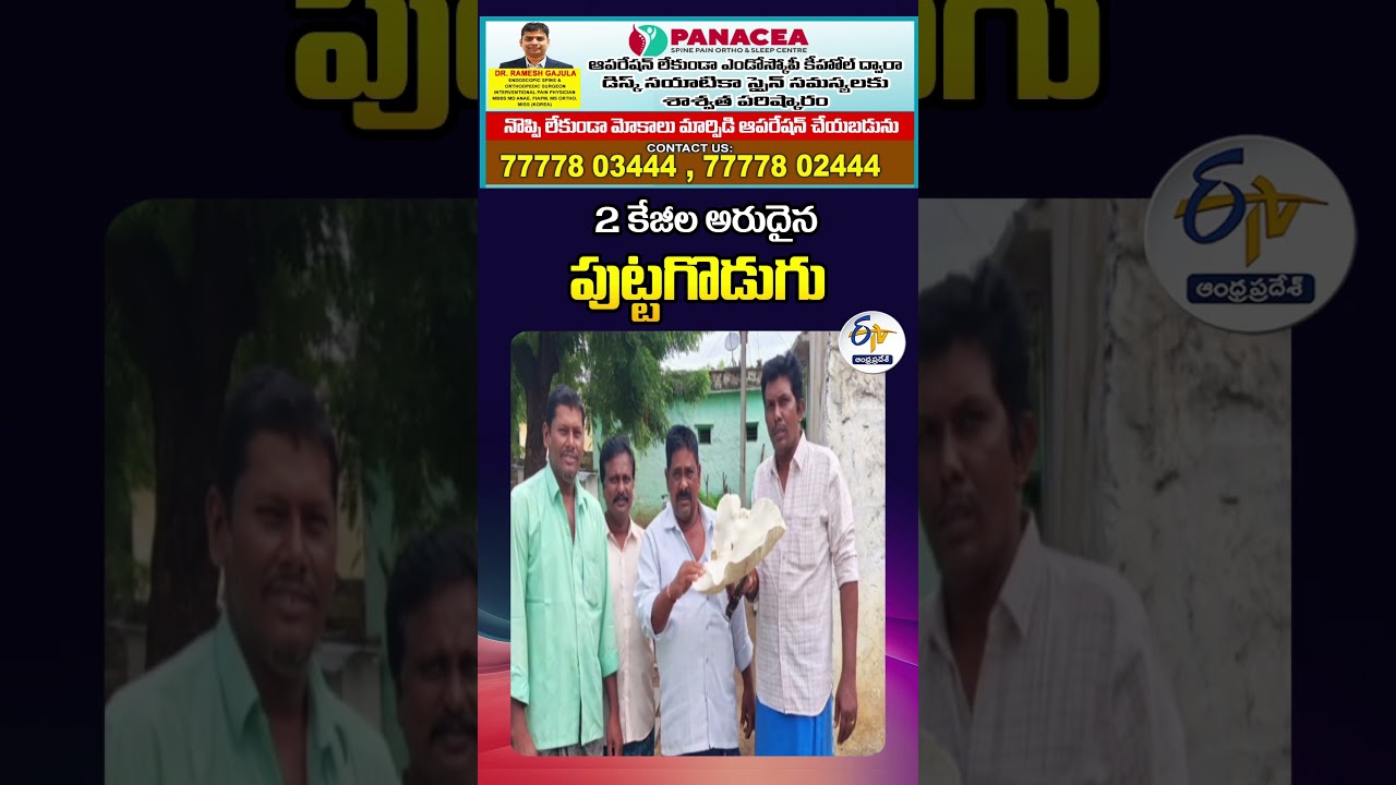 2 కేజీల అరుదైన పుట్టగొడుగు 2 కేజీల అరుదైన పుట్టగొడుగు