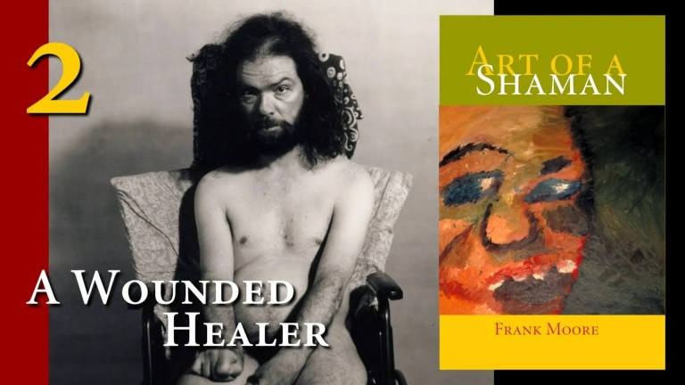 Episode 2 – A Wounded Healer – Let Me Be Frank Episode 2 – A Wounded Healer – Let Me Be Frank