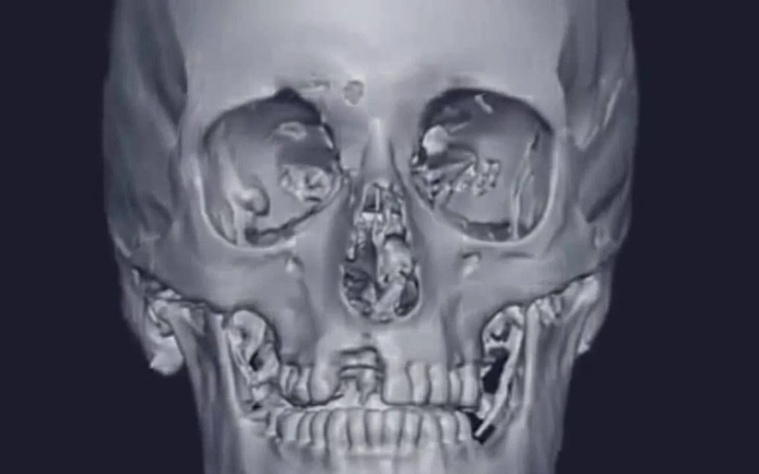 The Real Jigsaw Murderer – Stephen Marshall