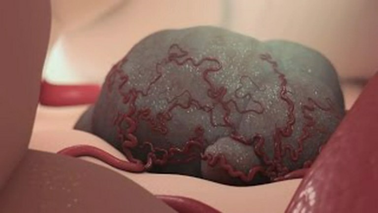 Cancer Treatment Cancer Treatment
