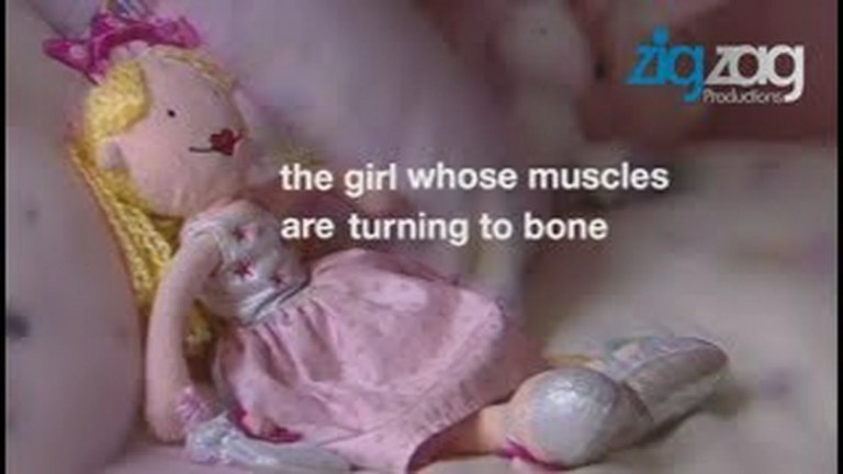 The Girl Whose Muscles Are Turning To Bone The Girl Whose Muscles Are Turning To Bone