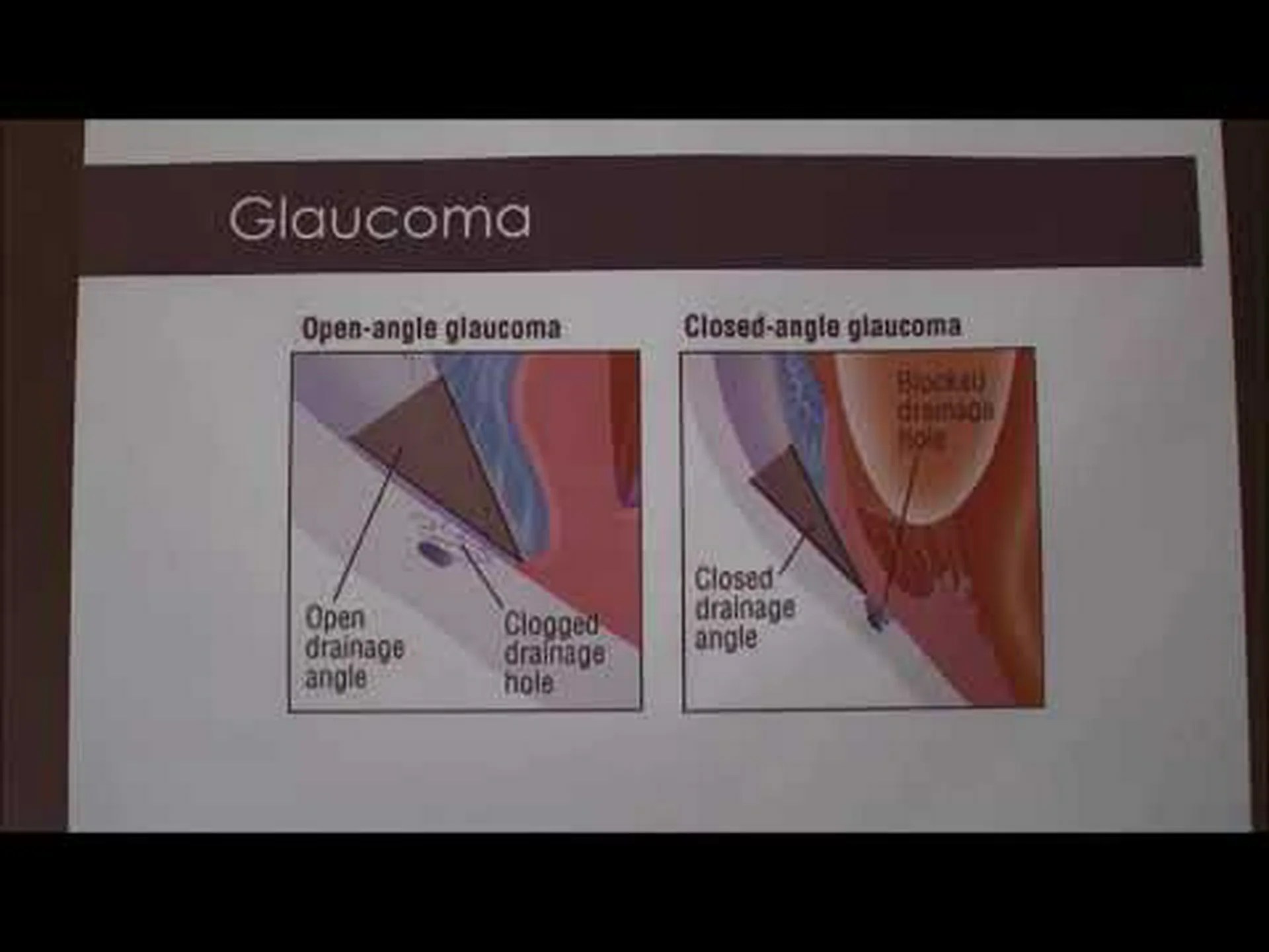 バセットハウンドに見られる11の一般的な健康上の問題 バセットハウンドに見られる11の一般的な健康上の問題