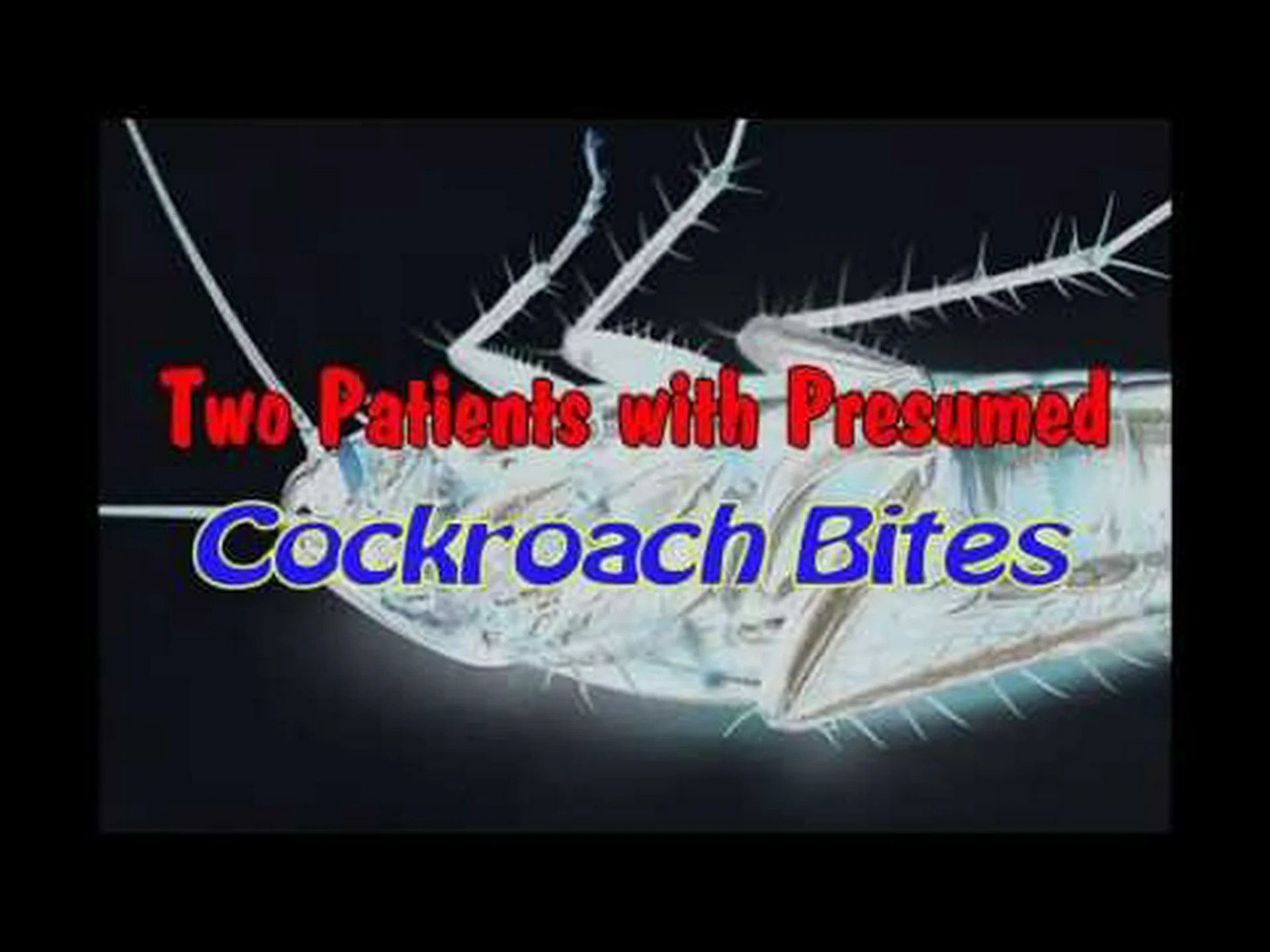 カナダ最古の国立公園は必見の目的地です カナダ最古の国立公園は必見の目的地です