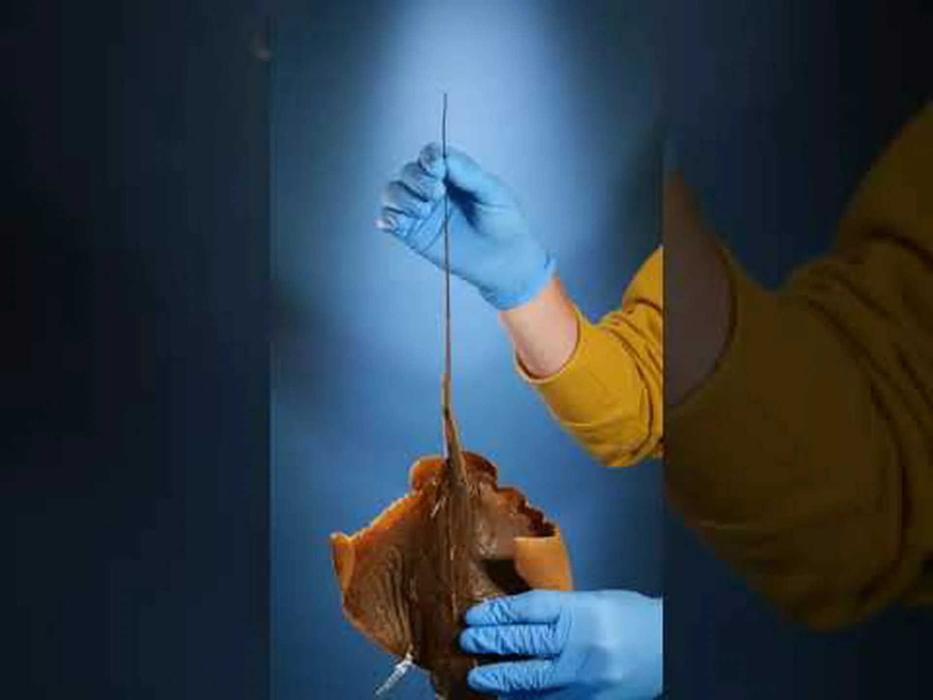 アカエイの歯: 知っておくべきことすべて アカエイの歯: 知っておくべきことすべて