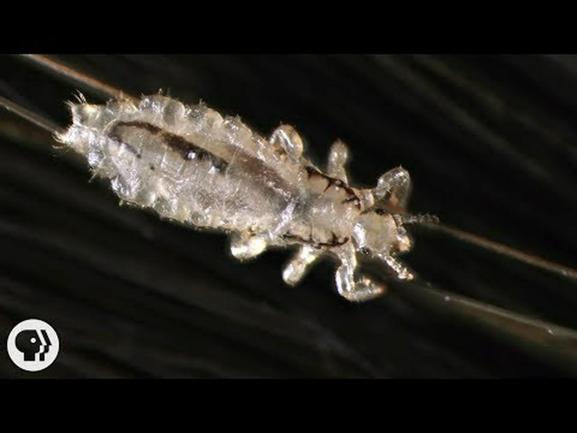 髪の毛のように見える虫を発見 髪の毛のように見える虫を発見