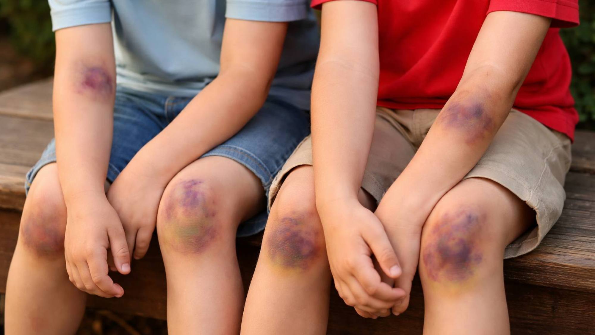 850 afectados y su impacto en la salud 850 afectados y su impacto en la salud