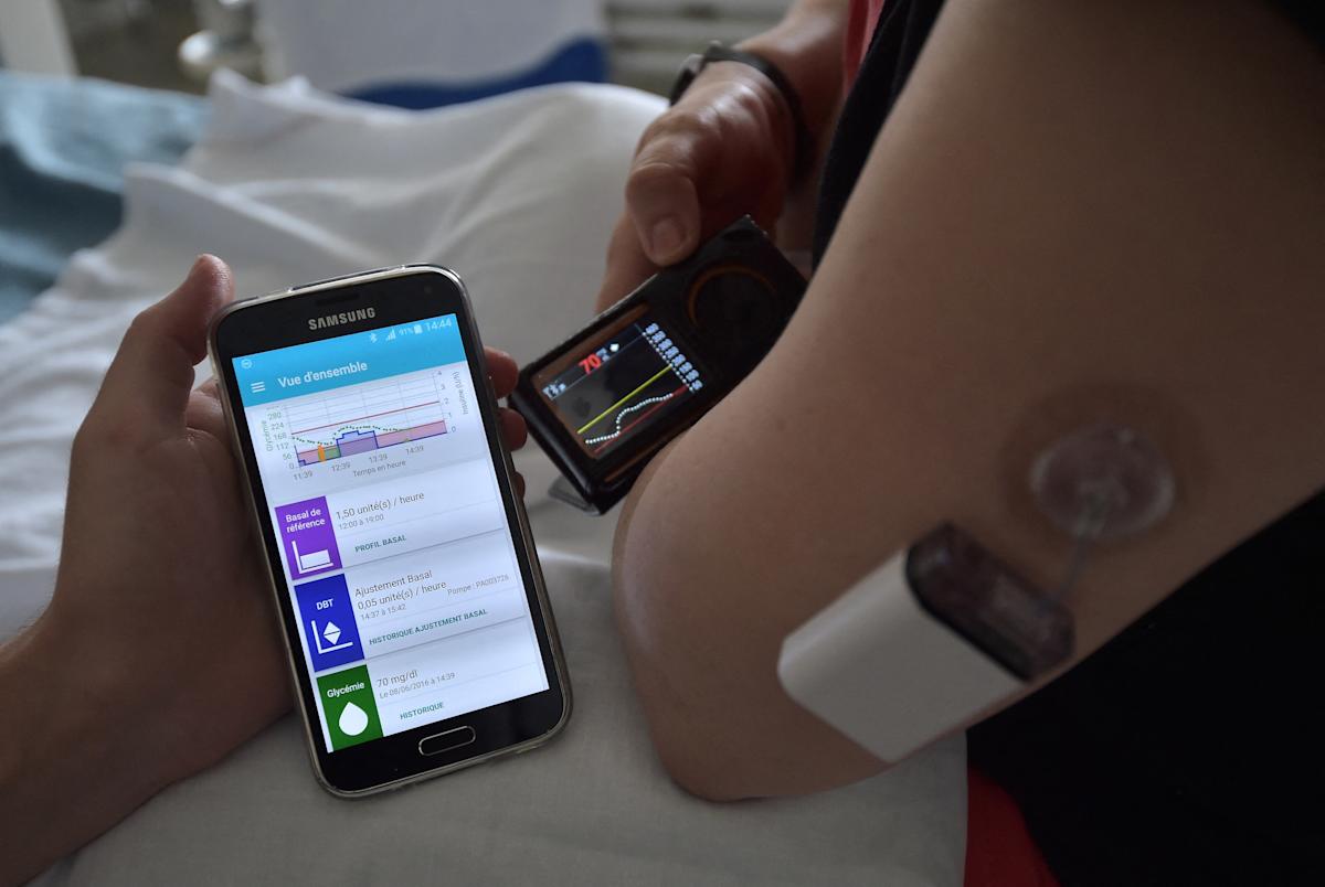 England’s NHS will present synthetic pancreas to hundreds of diabetes sufferers England’s NHS will present synthetic pancreas to hundreds of diabetes sufferers