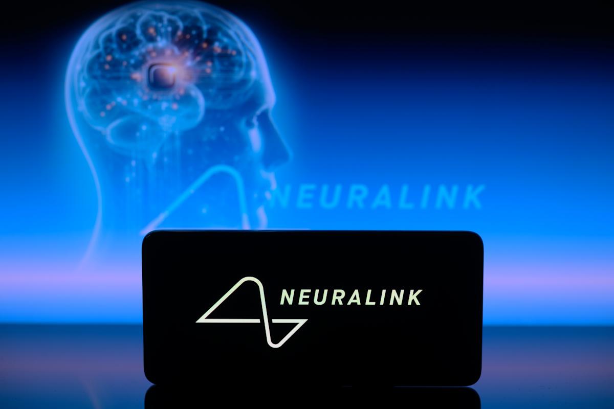 This is a video of the primary human Neuralink affected person controlling a pc together with his ideas This is a video of the primary human Neuralink affected person controlling a pc together with his ideas
