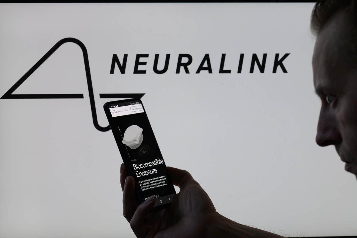 Neuralink says it could have mounted its mind implant downside Neuralink says it could have mounted its mind implant downside