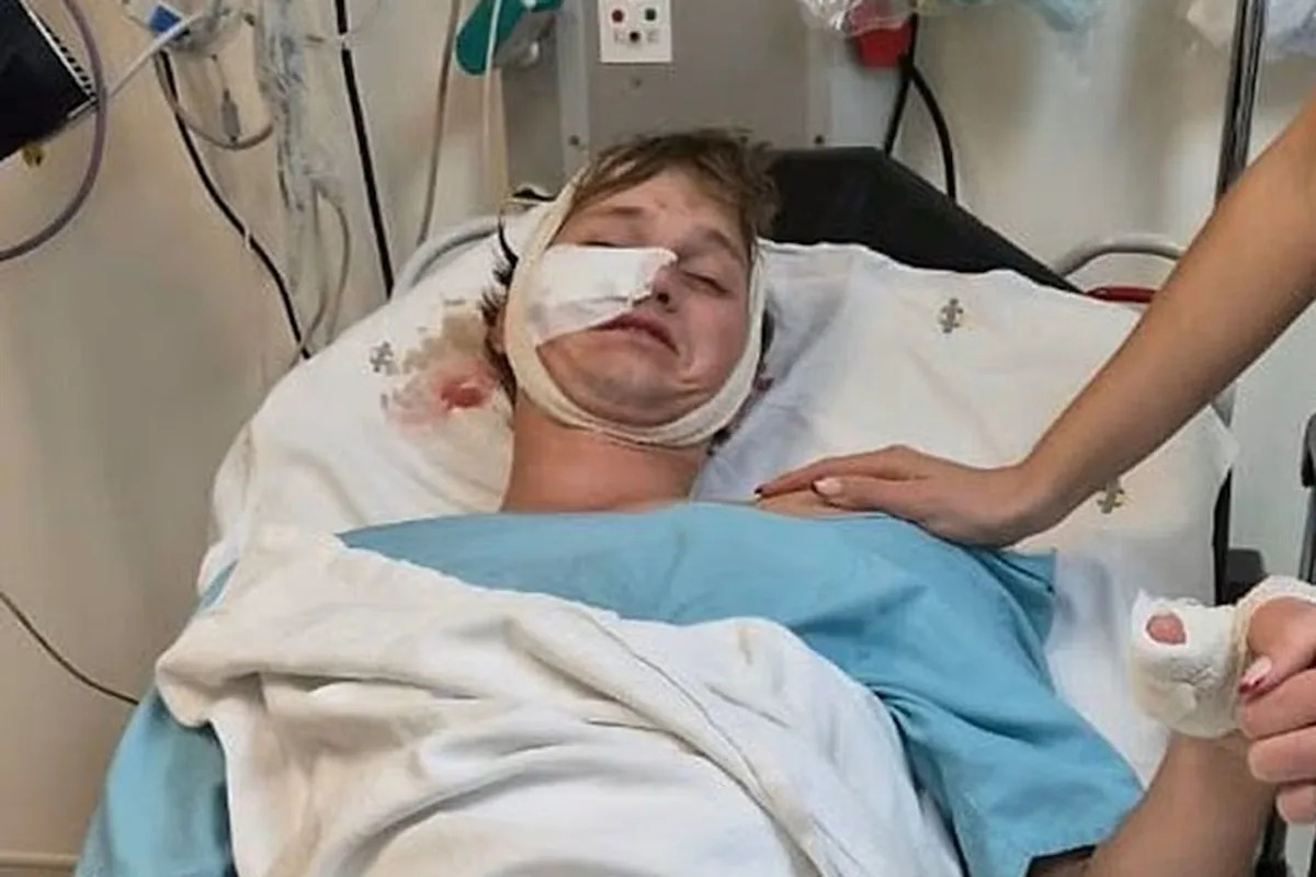 Man Attacked by Hyenas at Bachelor Party Says His Dad Found Him in ‘Pool of Blood’: ‘Had to Fight to Survive’ (Exclusive) Man Attacked by Hyenas at Bachelor Party Says His Dad Found Him in ‘Pool of Blood’: ‘Had to Fight to Survive’ (Exclusive)