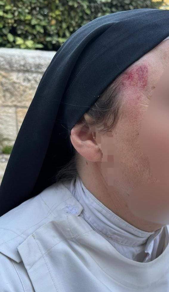 ‘Assault on city’s fundamental values’: Attack on nun in Jerusalem sparks widespread condemnation ‘Assault on city’s fundamental values’: Attack on nun in Jerusalem sparks widespread condemnation