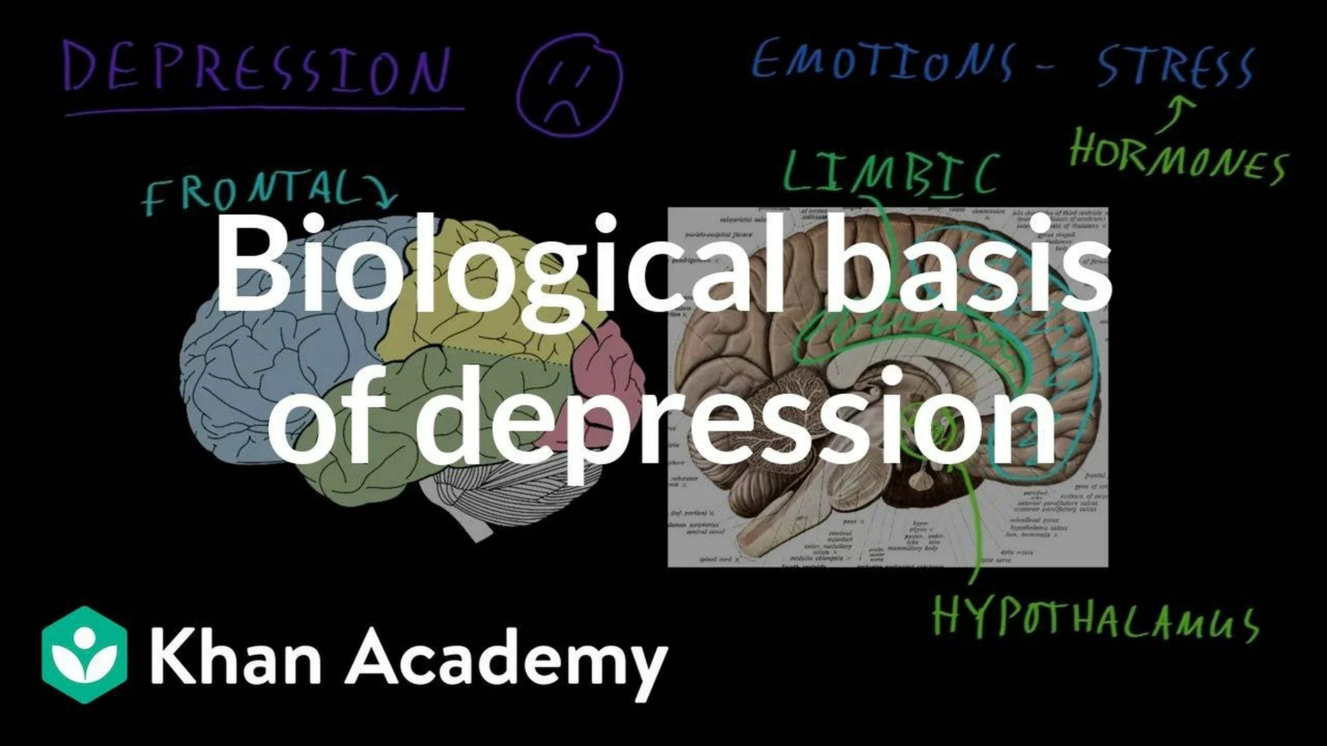 Important Depressive Disorder Important Depressive Disorder