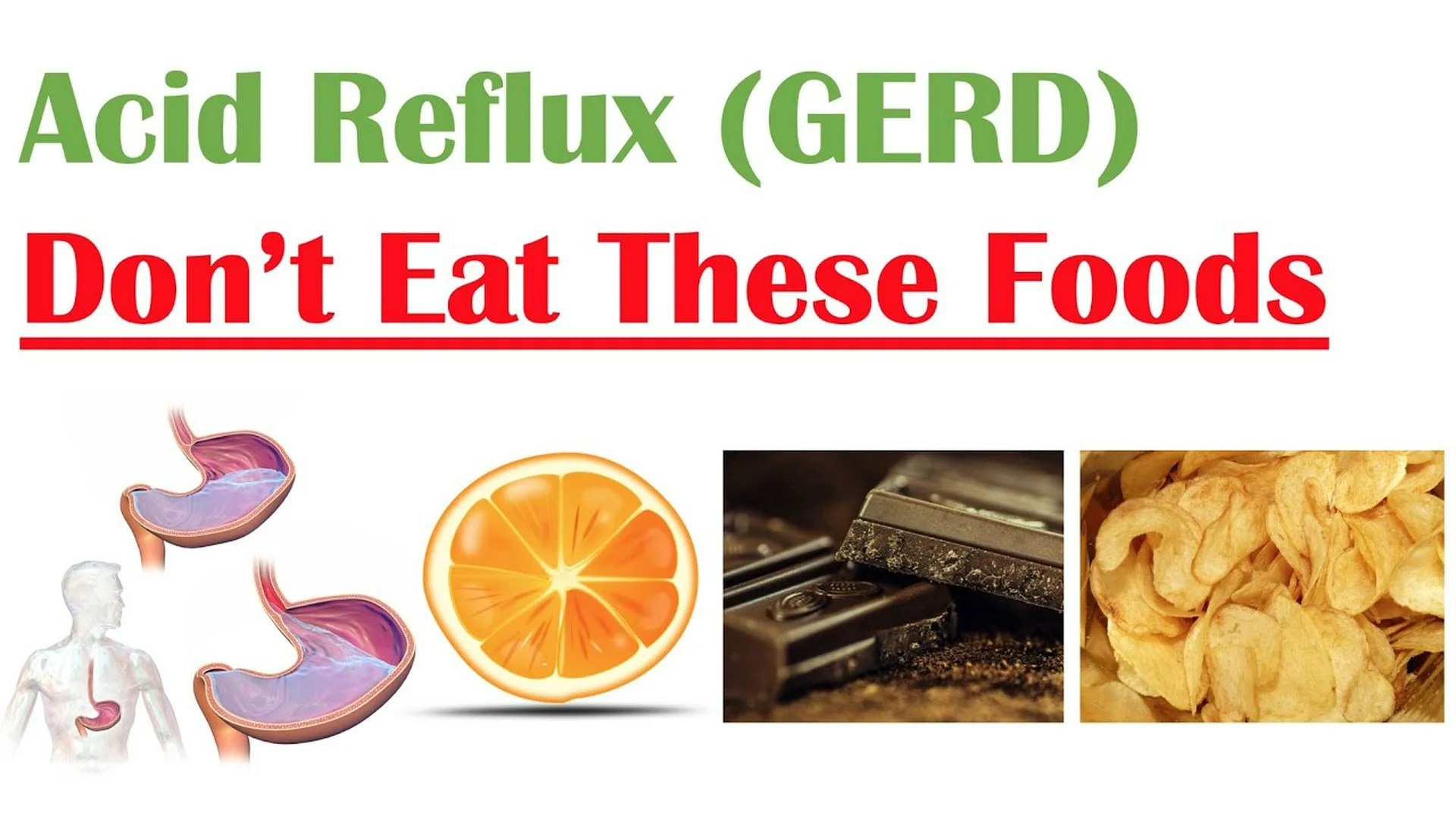 Foods to Avoid With GERD Foods to Avoid With GERD