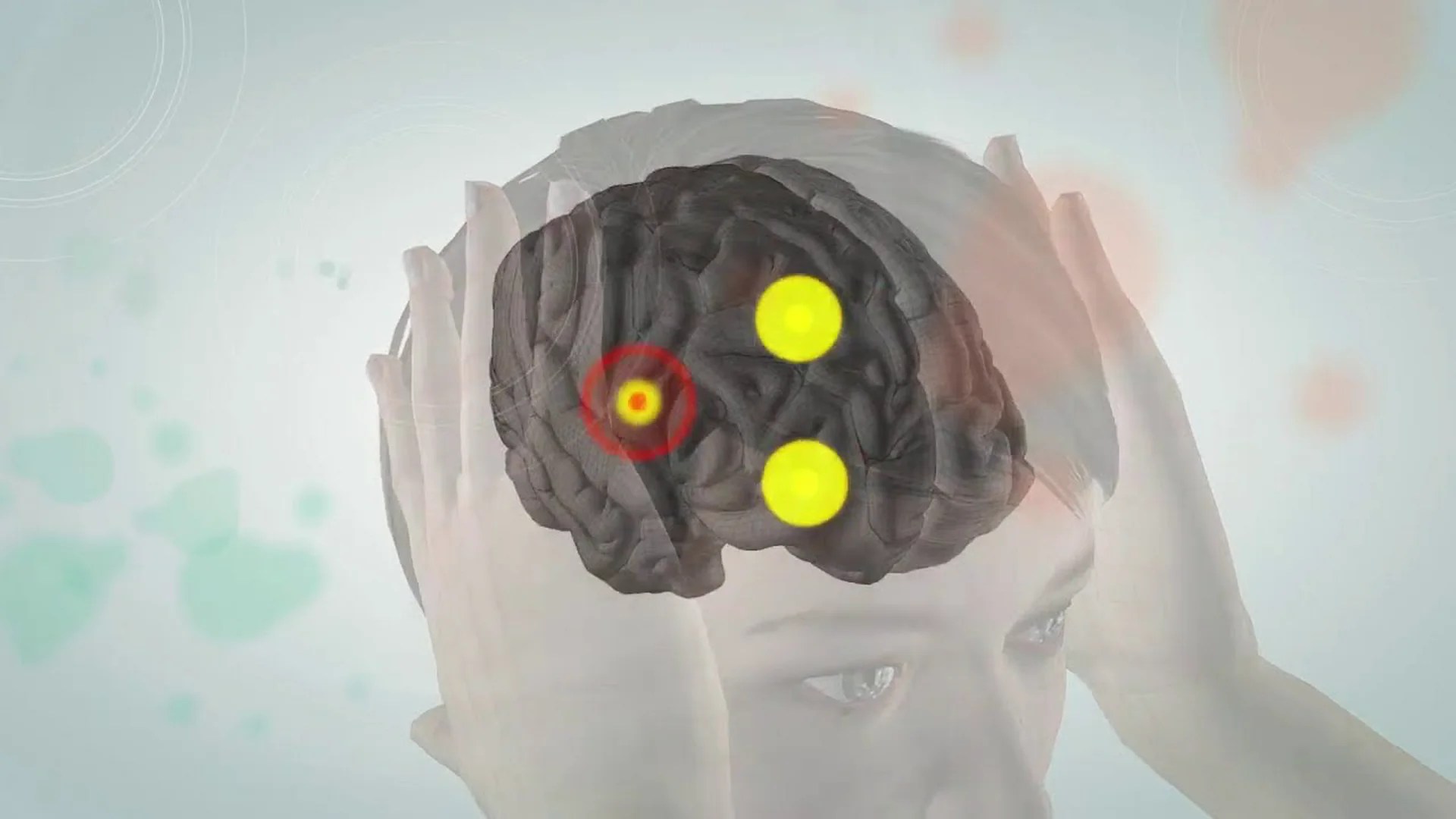 The Difference Between Headache Depression and Anxiety in Basic Neurological Terms The Difference Between Headache Depression and Anxiety in Basic Neurological Terms