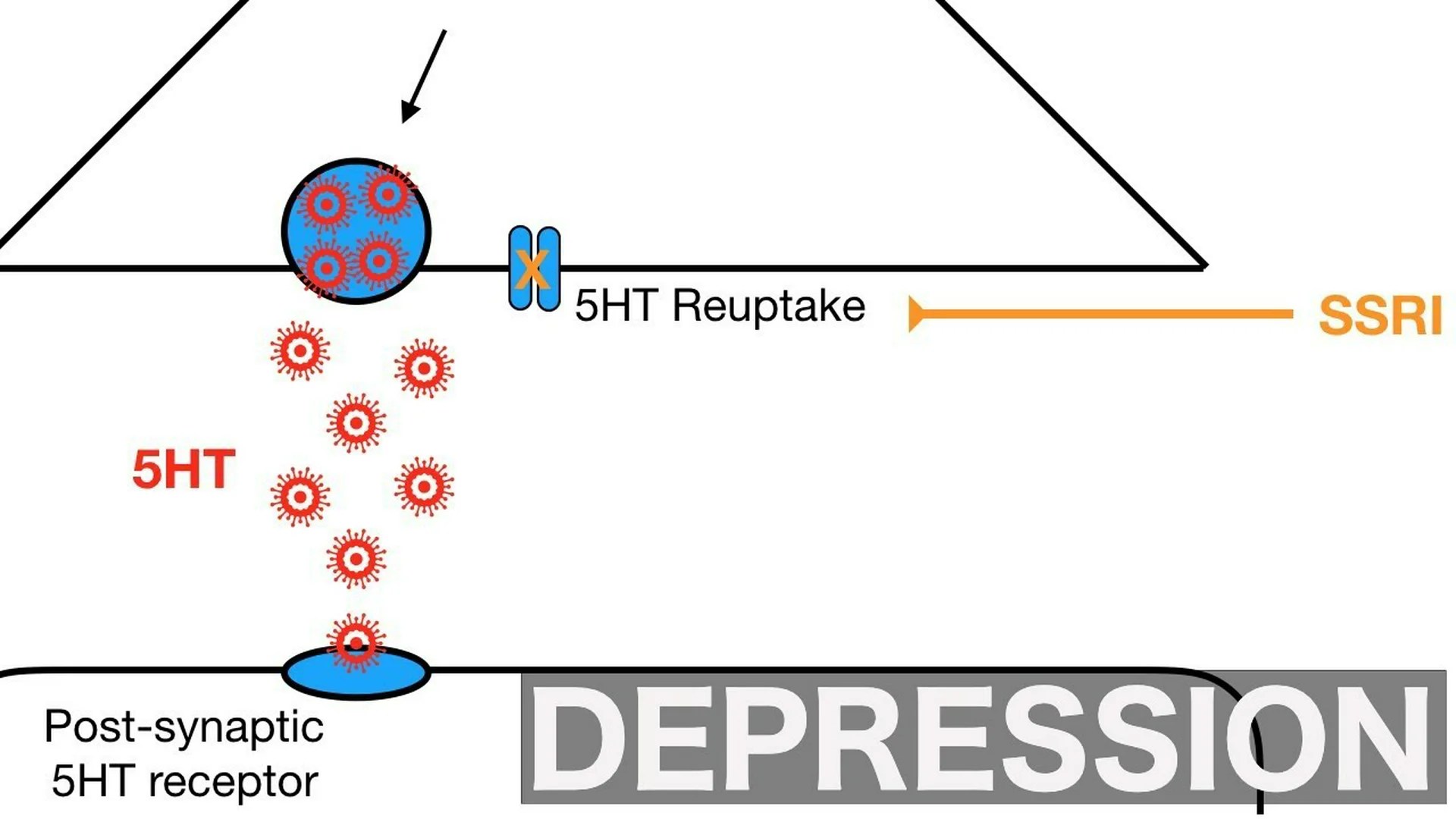 What Is Clinical Depression Significant Depressive Disorder? What Is Clinical Depression Significant Depressive Disorder?