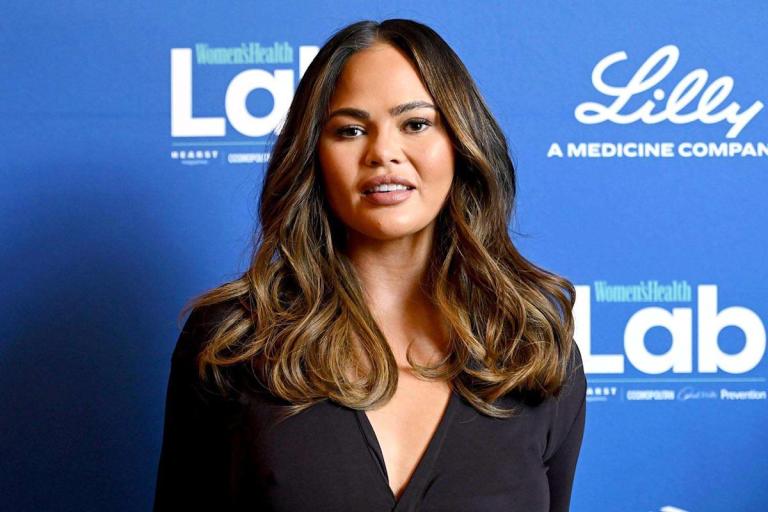 Chrissy Teigen Reveals She Underwent a ‘Hairline Lowering Procedure’ After Photo of Her Bandaged Face Goes Viral Chrissy Teigen Reveals She Underwent a ‘Hairline Lowering Procedure’ After Photo of Her Bandaged Face Goes Viral