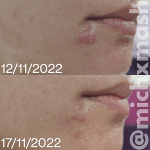 CICAPLAST RUTINA REPARADORA GEL LAVANT B5+ + CICAPLAST BAUME B5+40ML CICAPLAST RUTINA REPARADORA GEL LAVANT B5+ + CICAPLAST BAUME B5+40ML