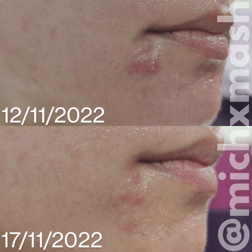 CICAPLAST RUTINA REPARADORA GEL LAVANT B5+ + CICAPLAST BAUME B5+40ML