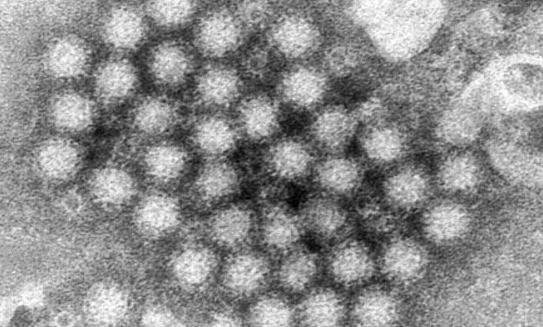 Nasty norovirus is back with full force, stomach virus cases surge in US Nasty norovirus is back with full force, stomach virus cases surge in US
